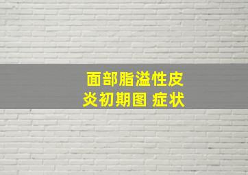 面部脂溢性皮炎初期图 症状